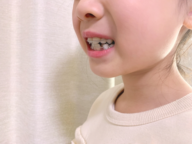 床矯正装置をつけた子ども