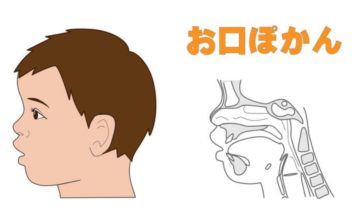 その仕草、成長のサインかも！子どもの「お口ポカン」と仕上げ磨きの重要性